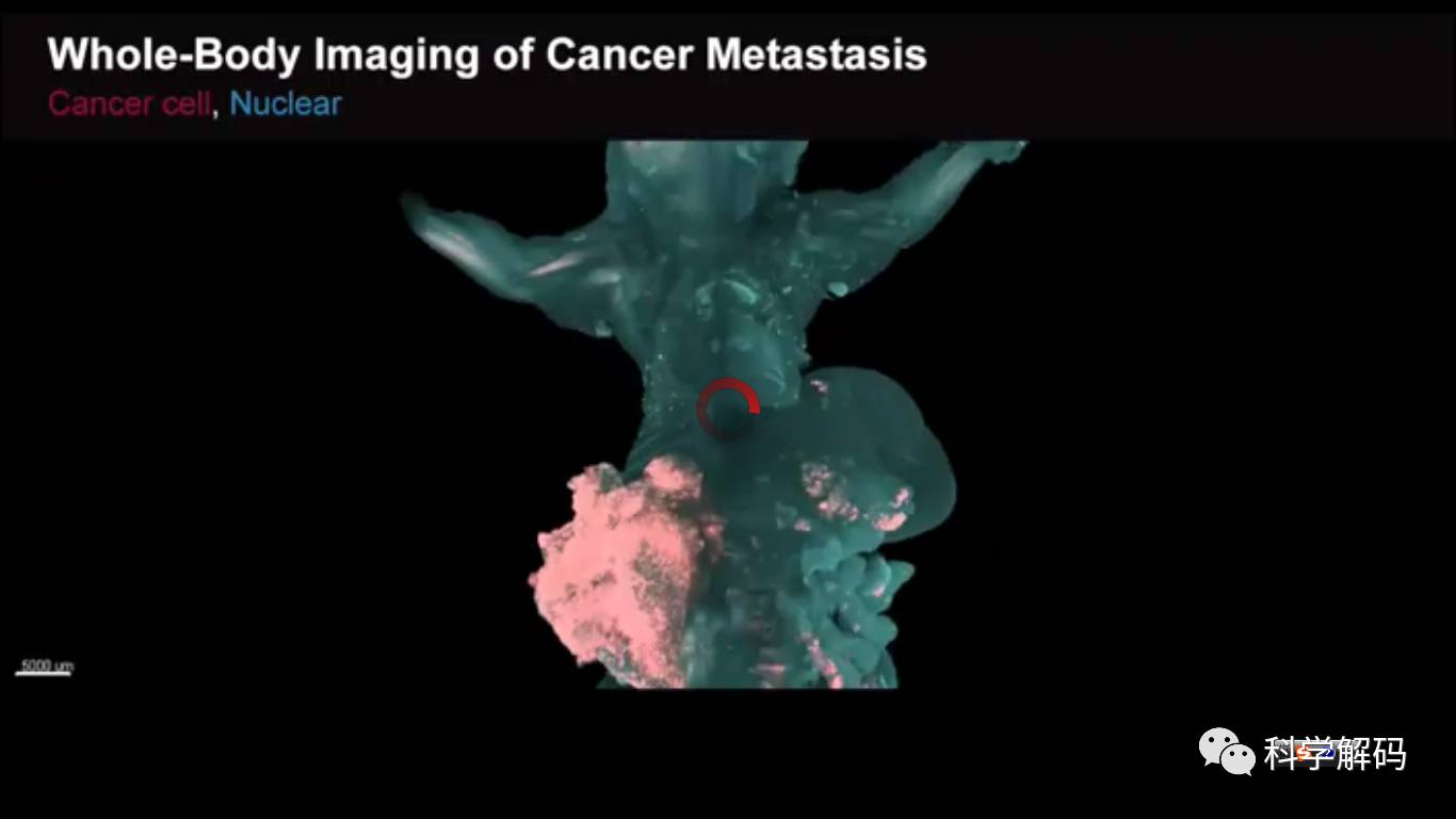 科学家拍摄癌细胞扩散到全身的过程太恐怖了