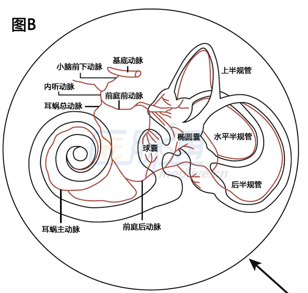 迷路动脉栓塞图片