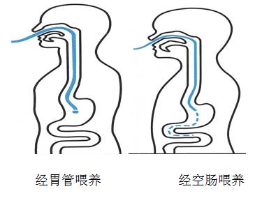 鼻肠管种类图片
