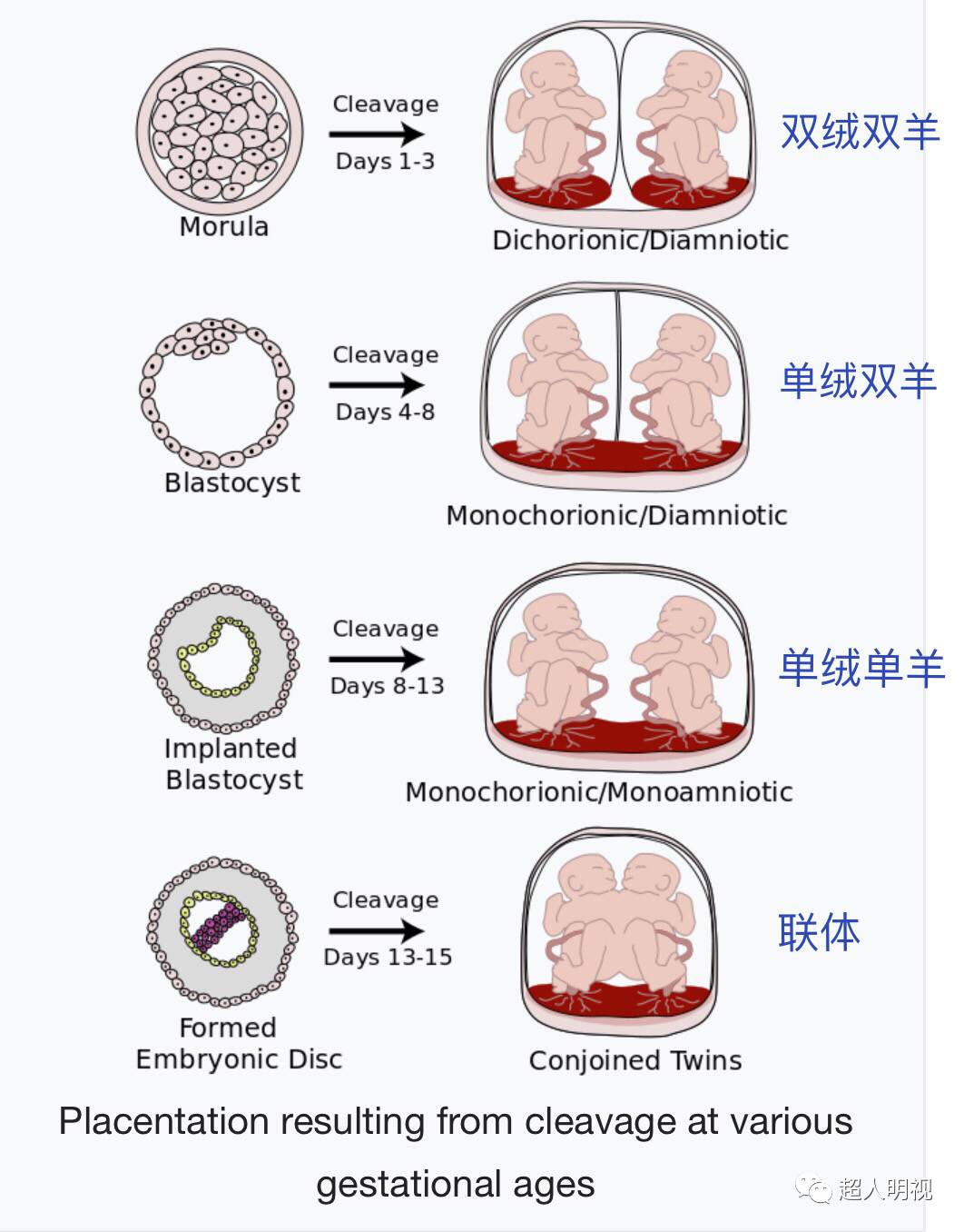 胚胎分裂越早,两个胎儿独立性越强