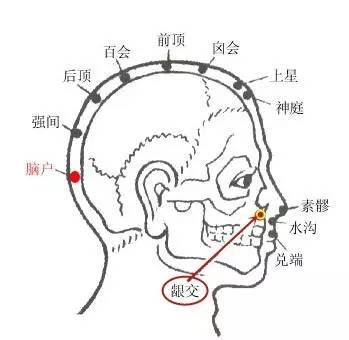 穴位配伍配風府治頸項急,不得顧;配承漿治口臭難近;配上關, 大迎,翳風