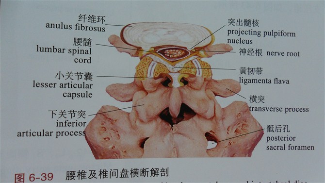 腰間盤突出ldp三刀法:骶髂肌群鬆解的肌肉能量技術met:髂腰肌的治療