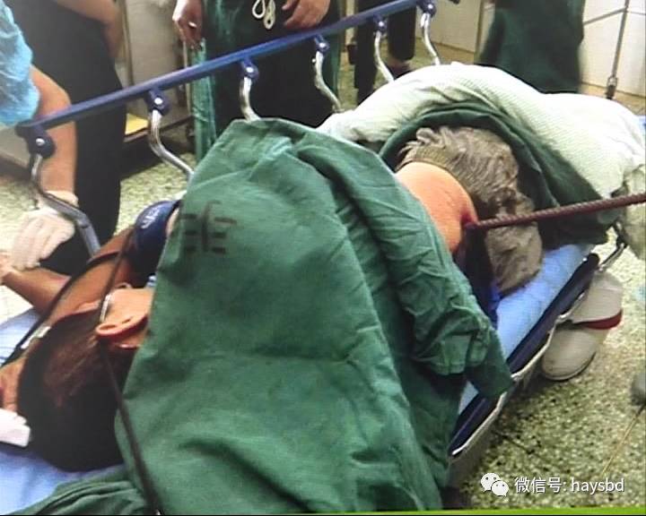 钢筋刺穿身体!钢筋离心脏只有一厘米!涟水伤者在一院被救治