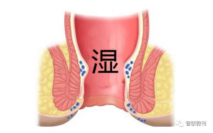 阴囊潮湿症状照片图片