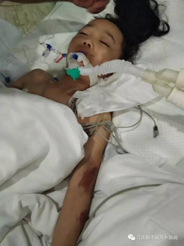青山车祸后续:女孩被夺走一条腿 近百村民发动朋友圈募捐
