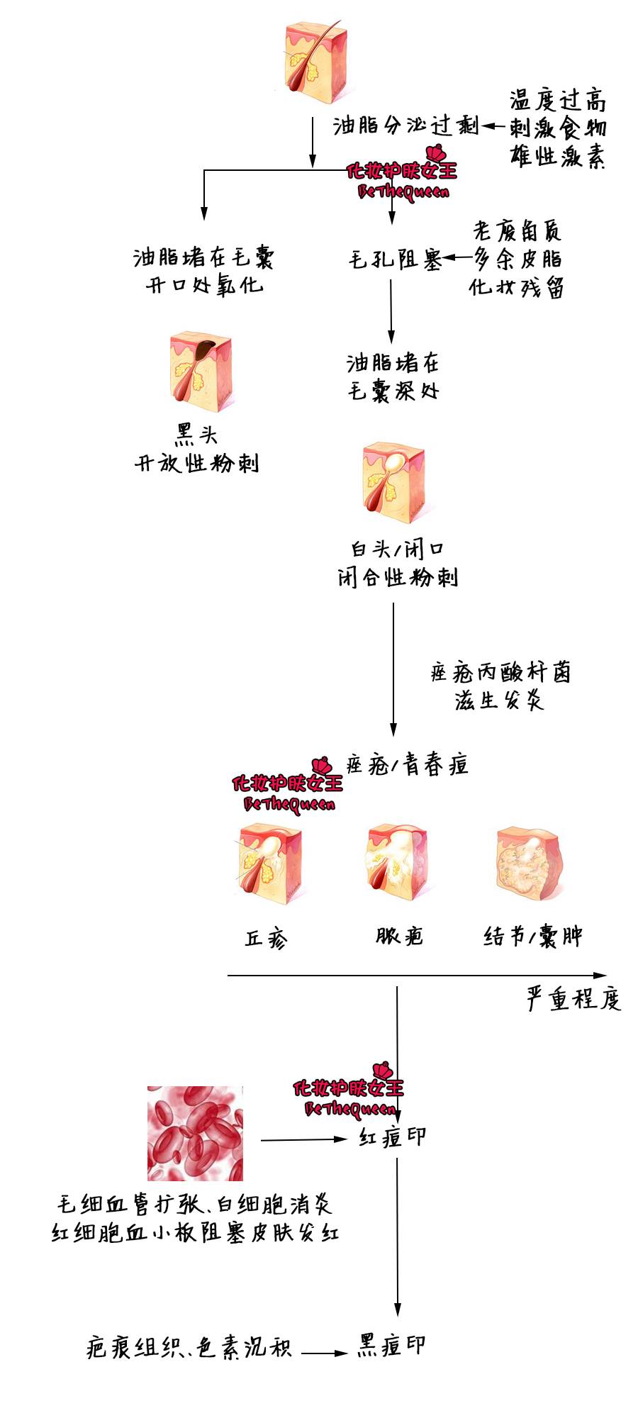 炒鸡讨厌的痘痘安利之前我们来看看安利一款祛痘利器今天给仙女宝宝们