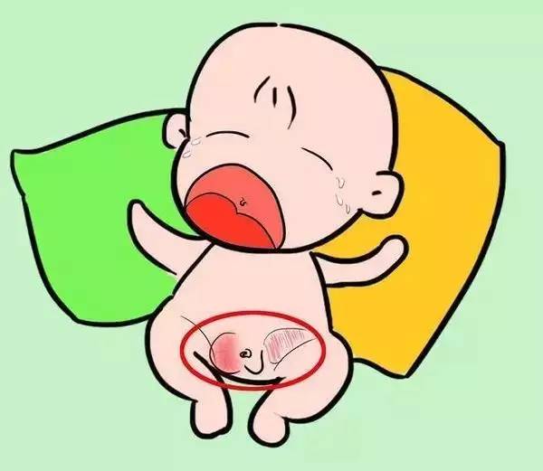的专利小儿腹股沟疝气很常见,多发于早产儿,女孩发病率比男孩小的多