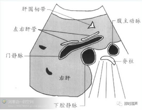 管,右肝管,下腔靜脈,肝圓韌帶1-1-7經第一肝門右肋下斜切面,顯示膽囊