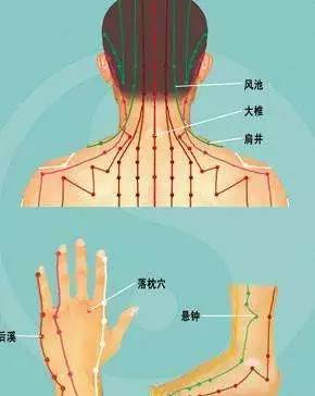 颈背部肌肉痉挛图片