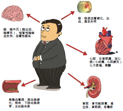 高血压会引起什么病症图片