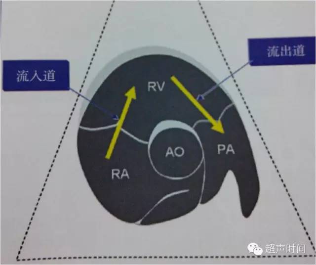 右室流出道切面图片