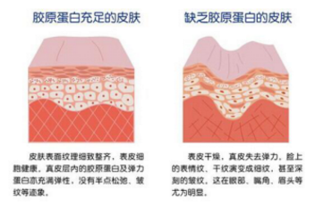 怎么通过食疗淡化斑点