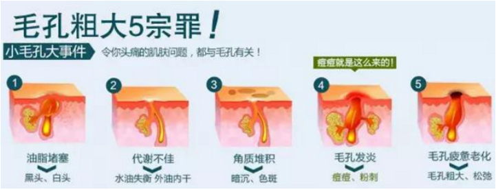 怎么通过食疗淡化斑点