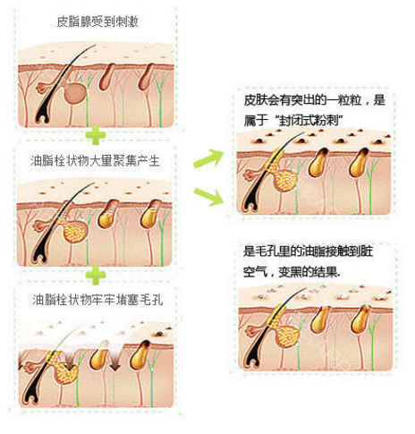 怎么通过食疗淡化斑点