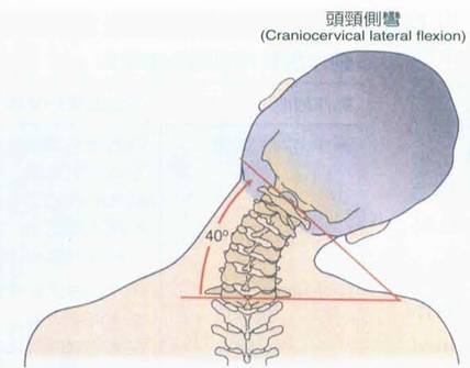 你的頸椎健康嗎測一測你的頸椎狀況