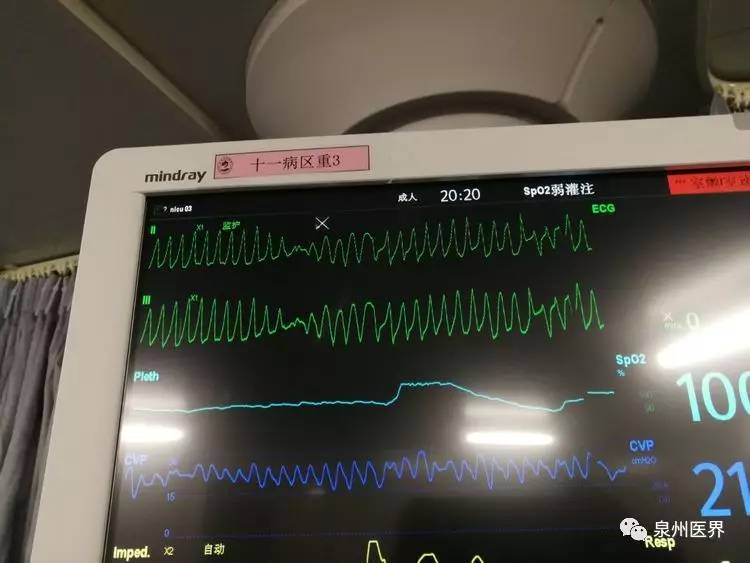 临床心电中心专家成员,中医院引进人才张登庆博士立即到场会同抢救