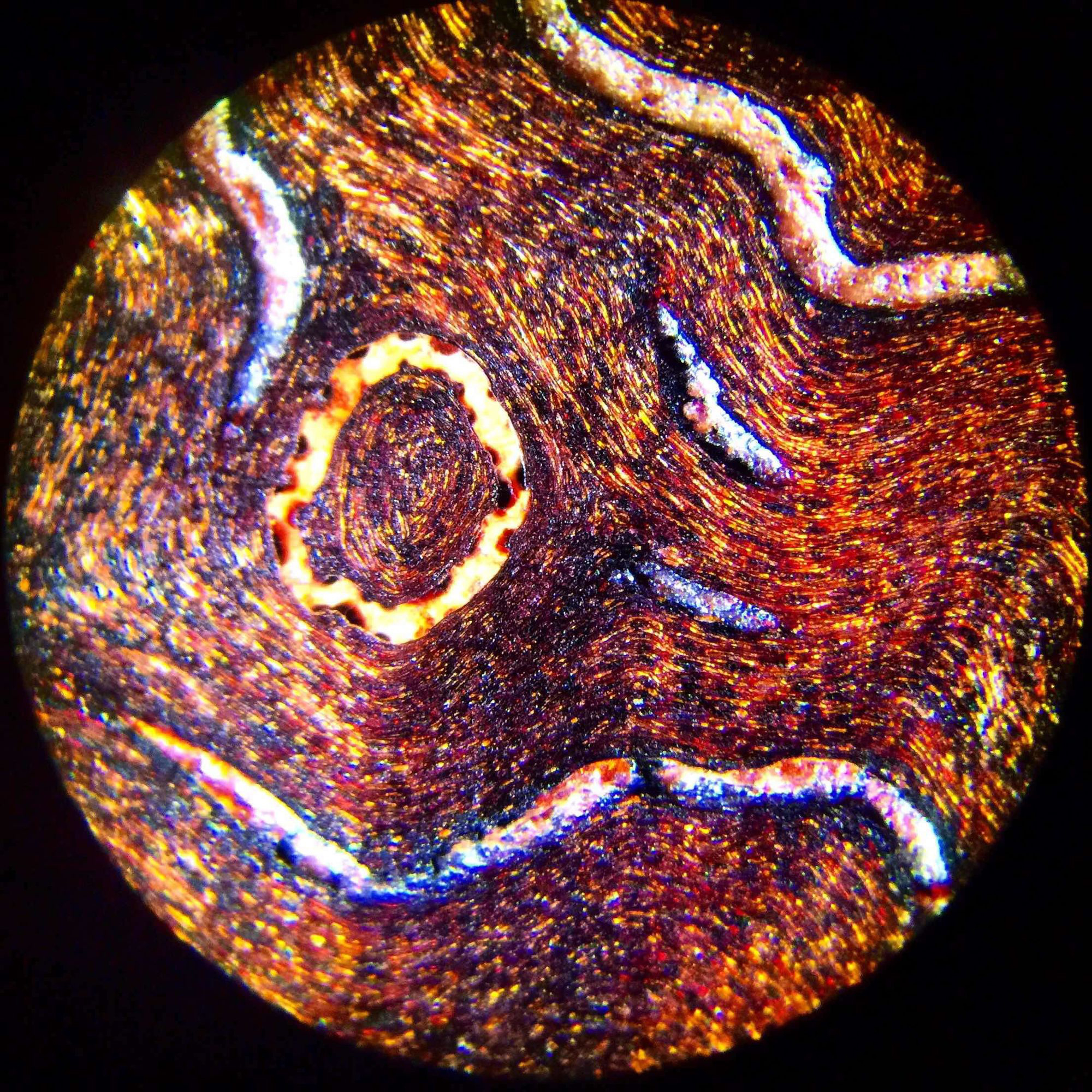 小叶间动脉显微镜图片