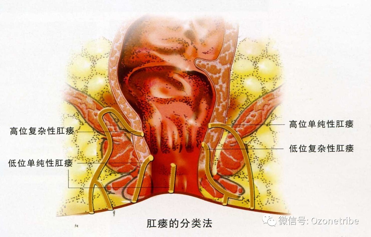 肛窦炎的症状图片欣赏图片
