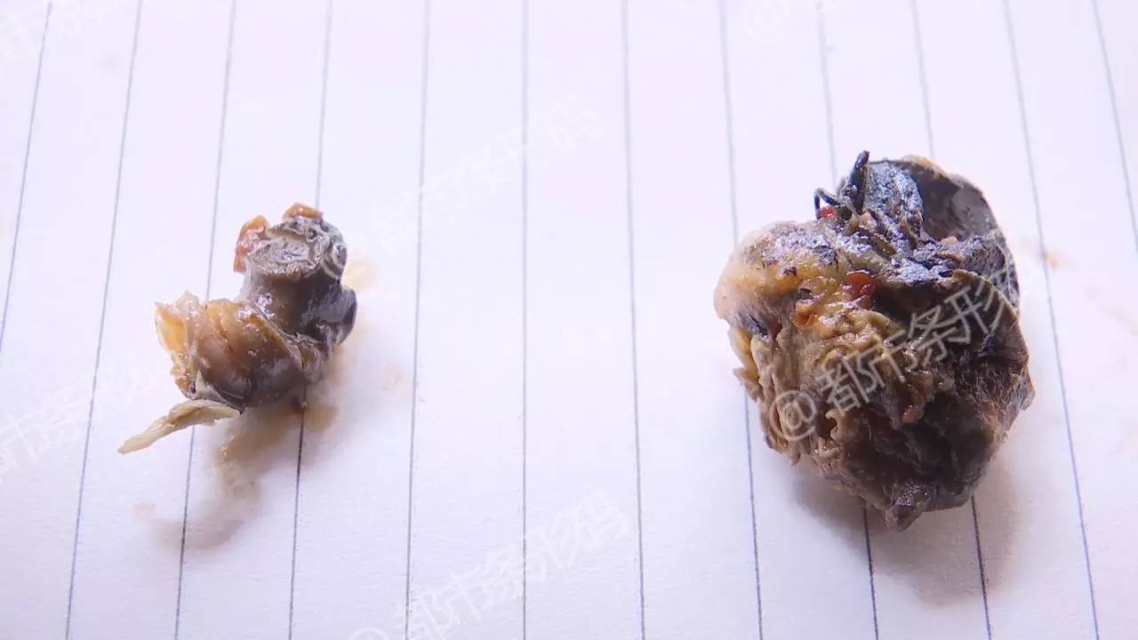 福寿螺寄生虫图片图片