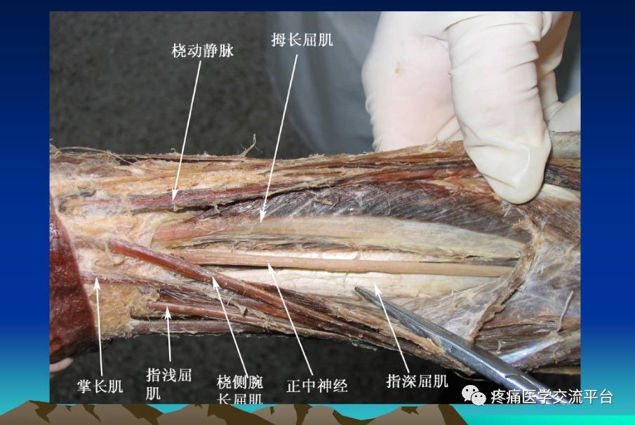 骨科解剖及手術切口入路