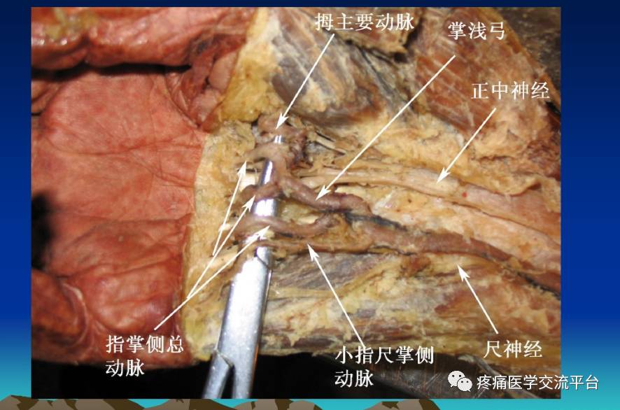 骨科解剖及手術切口入路