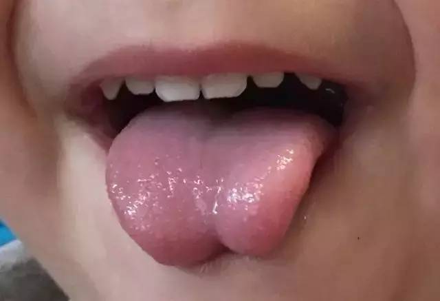 舌尖分叉图片