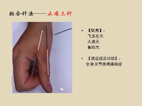 阴阳九针治咳嗽图解图片